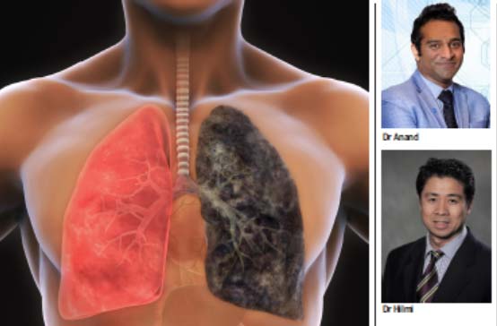 Lung Cancer And Non-Smokers 2 - Lung Cancer Network Malaysia